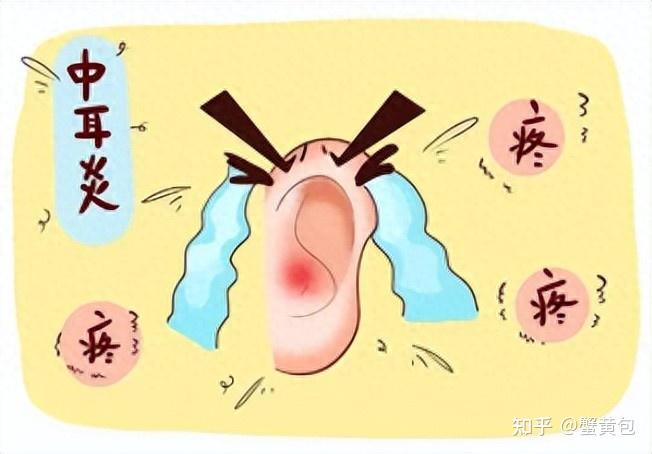 救命!终于找到中耳炎戴久也不疼的耳机,焊在耳朵上