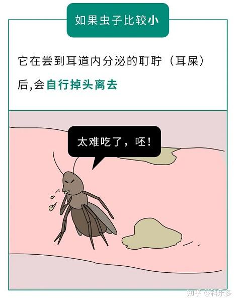 那些不小心进入身体的异物,最后咋样了? - 知乎