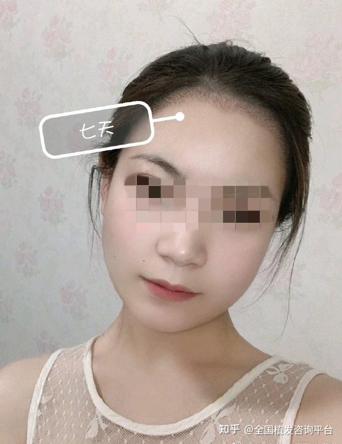 上海植发医院排名(上海植发医院排名前十)