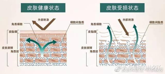 皮肤屏障是什么？你都了解吗？ - 知乎