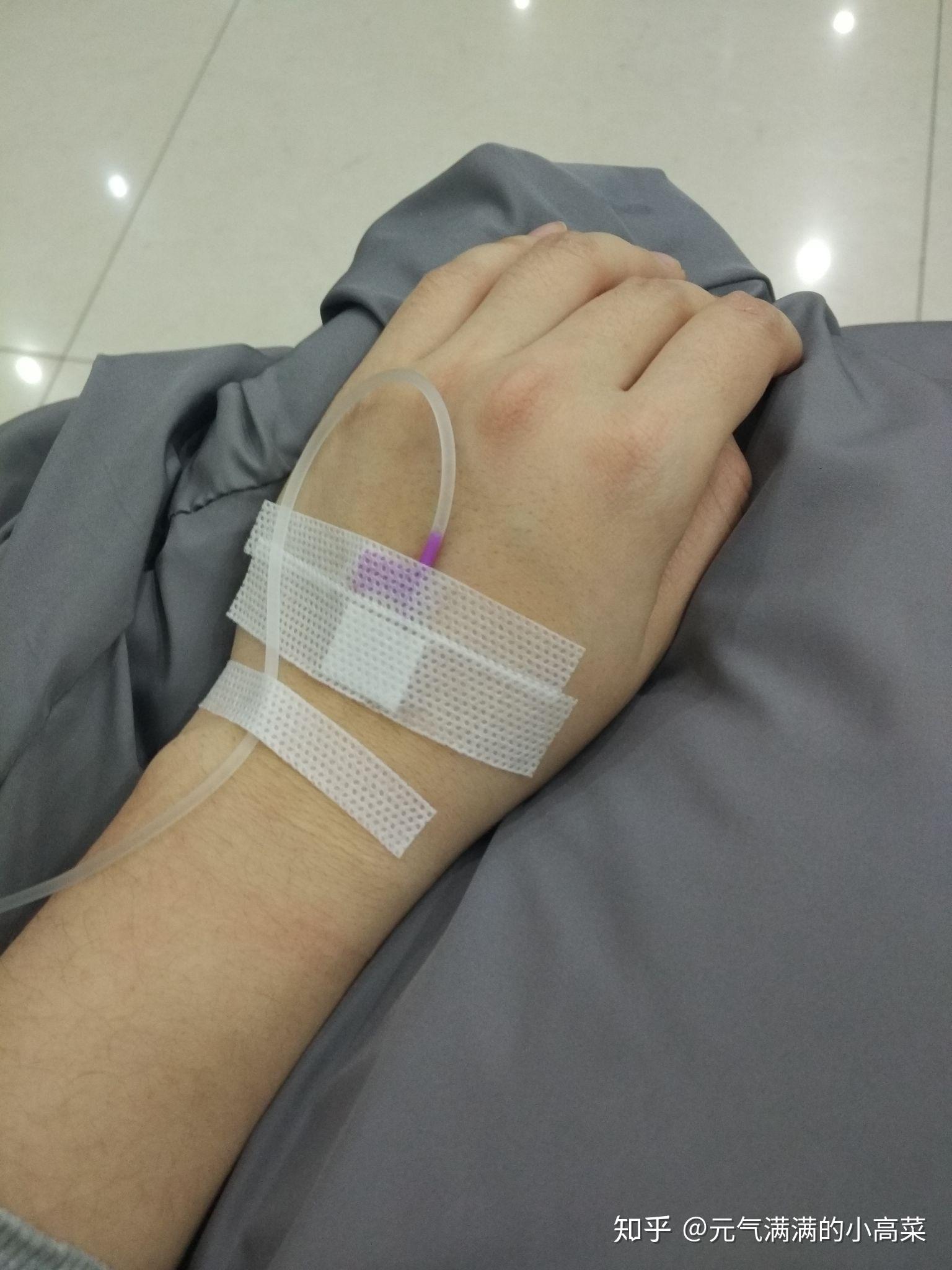 发烧烧到39度以上是什么感觉