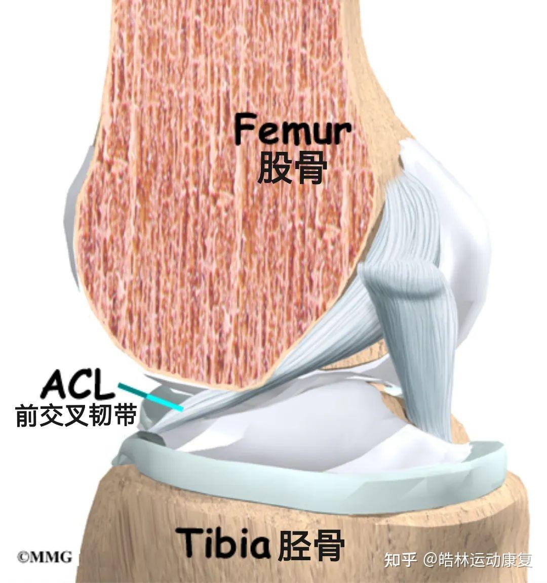 前十字韧带损伤康复治疗指南 - 知乎
