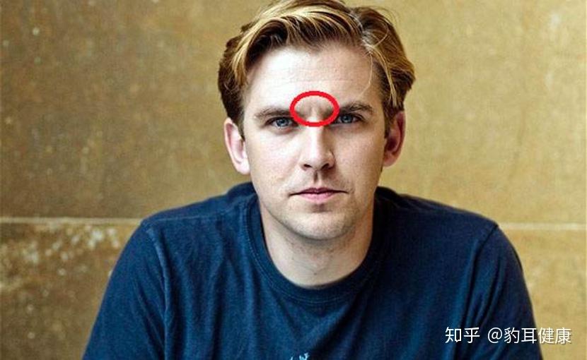印堂发黑”是凶兆？注意：可能是这里病了- 知乎