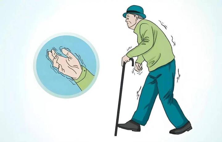 帕金森患者步行训练：3个动作+2个辅助工具，降低跌倒风险 - 知乎