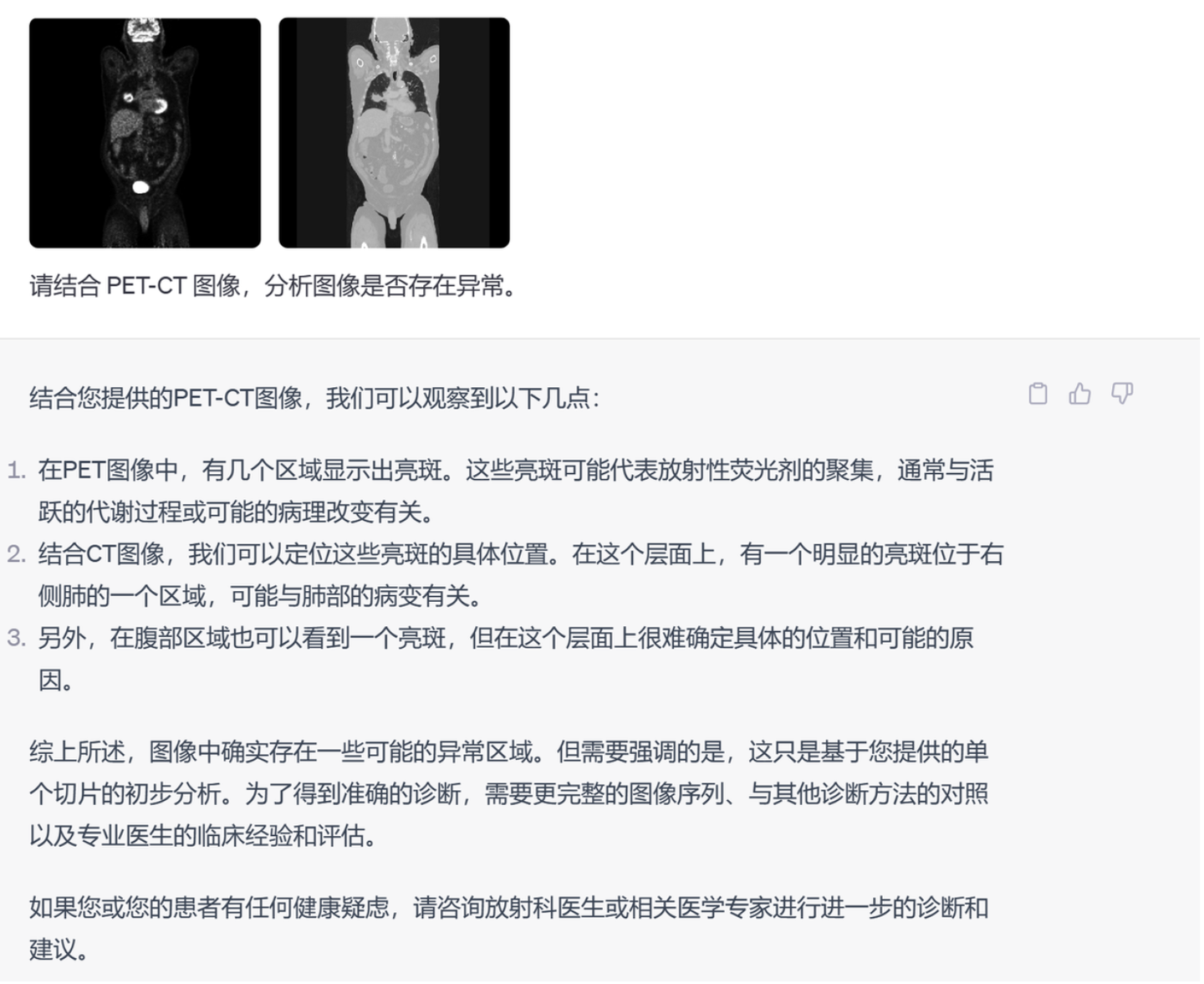 GPT-4V 医疗场景初探- 知乎