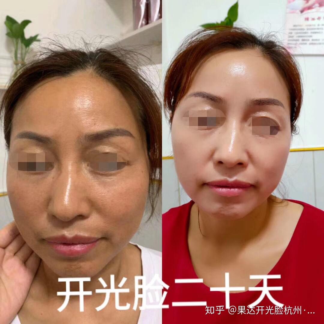 果达开光脸 - 知乎