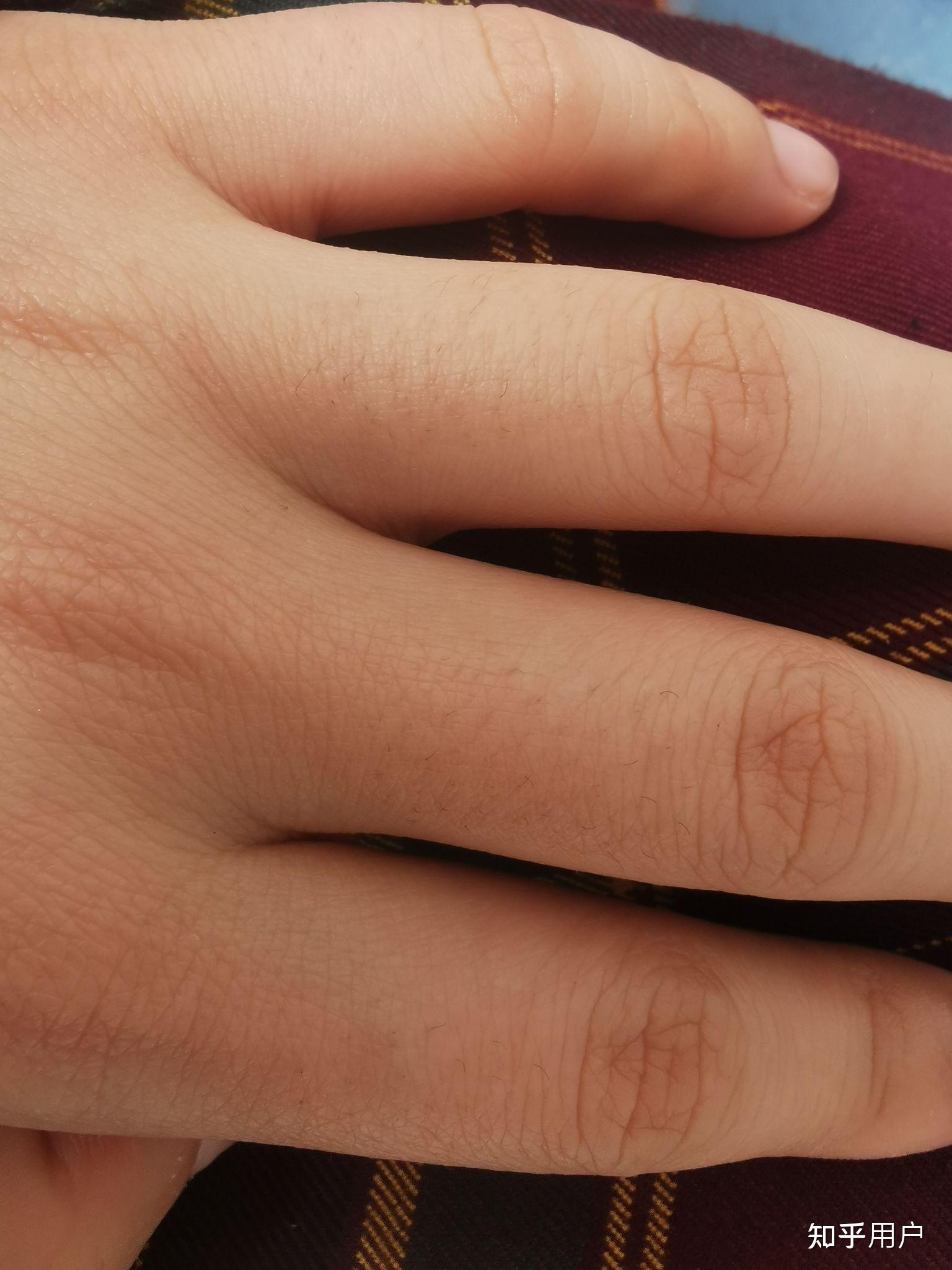 请问女生手毛会越刮越多越刮越粗吗