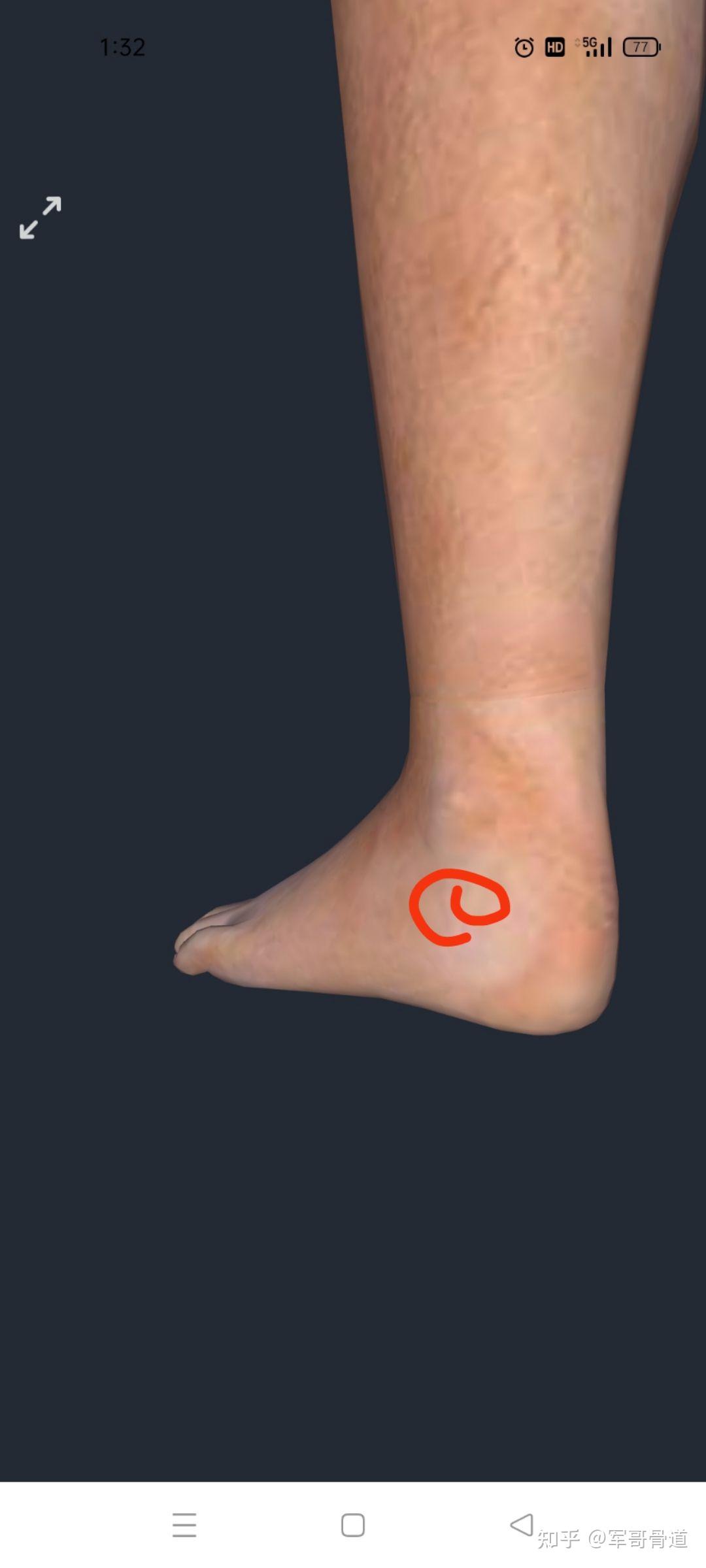 跑了几天步,脚腕隐隐作痛是怎么回事? - 知乎