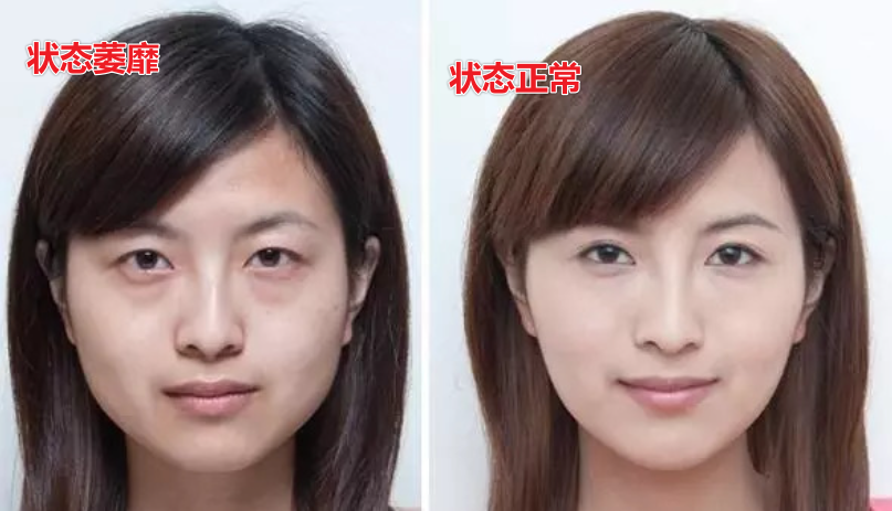 女人老了,到底该扮嫩还是放任老态?看这8组对比,差距好大! - 知乎
