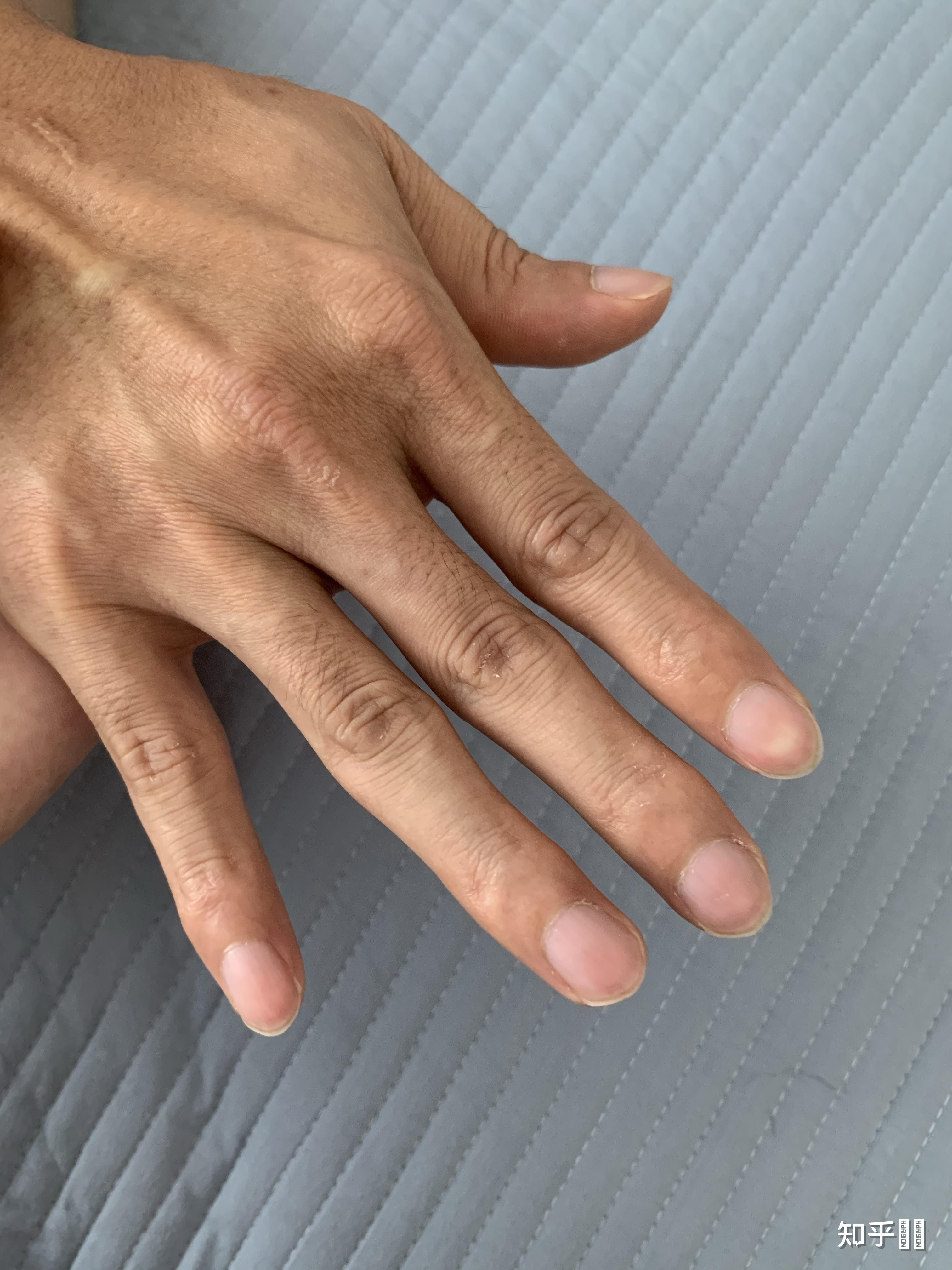 男朋友手指长这样是不是有问题? - 知乎