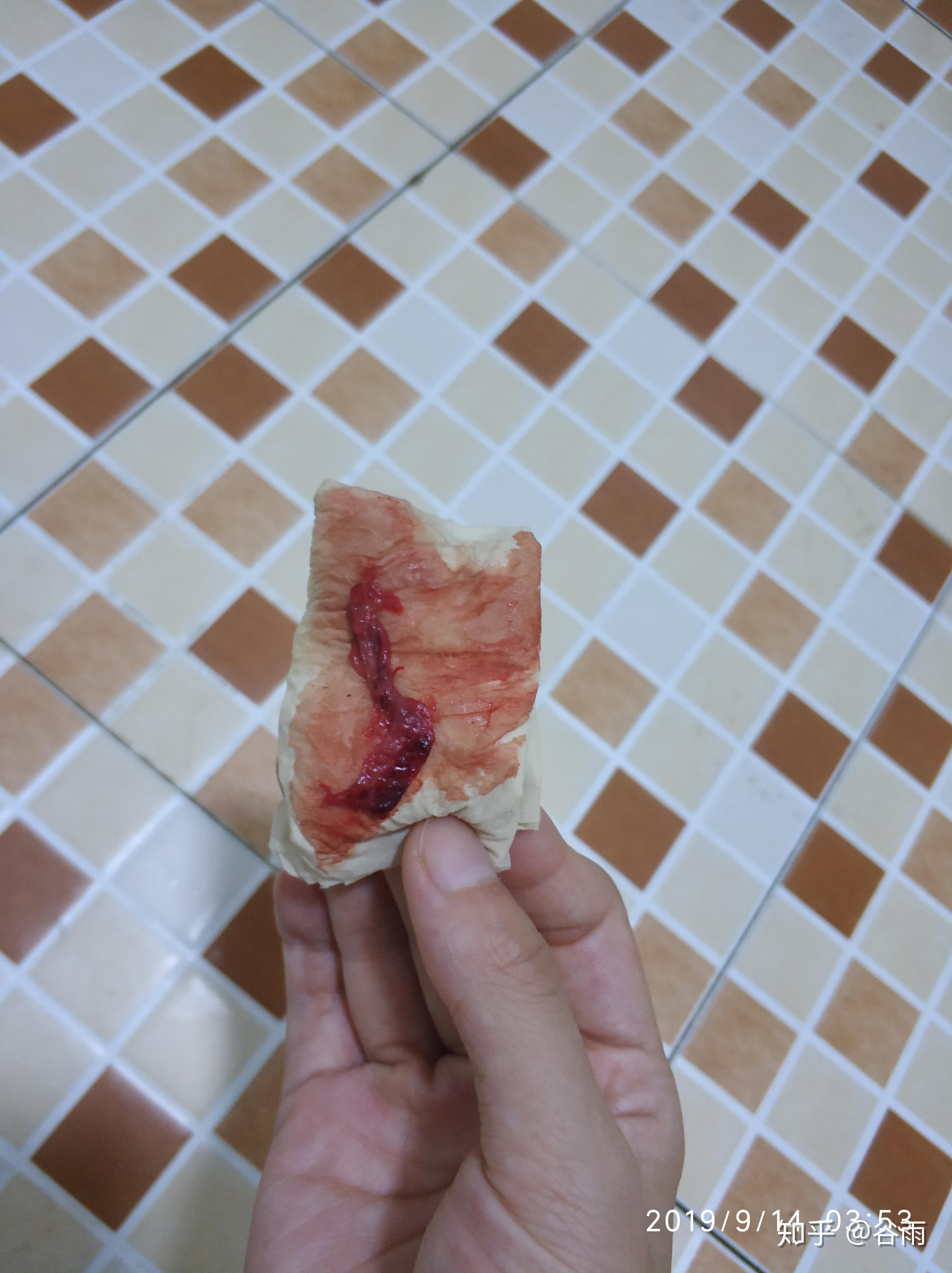 简单记述药流过程