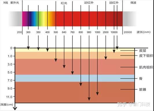 由红外线理疗灯深入了解红外在医学中的应用 - 知乎