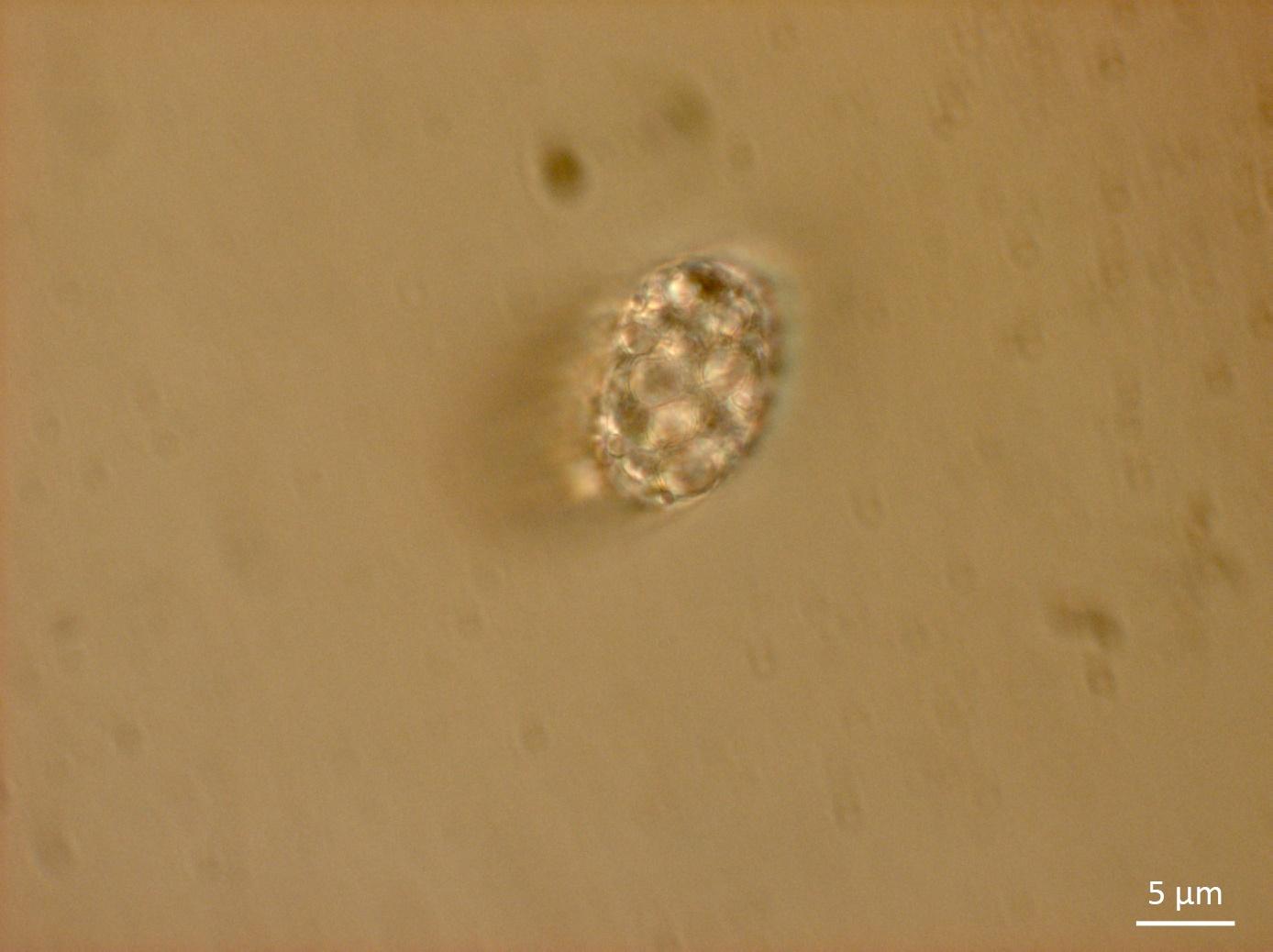 “重度结石细菌”——小石子细菌Achromatium （1）
