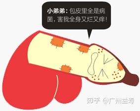 丁丁里隐藏的白色豆腐渣样的东西是啥? - 知乎