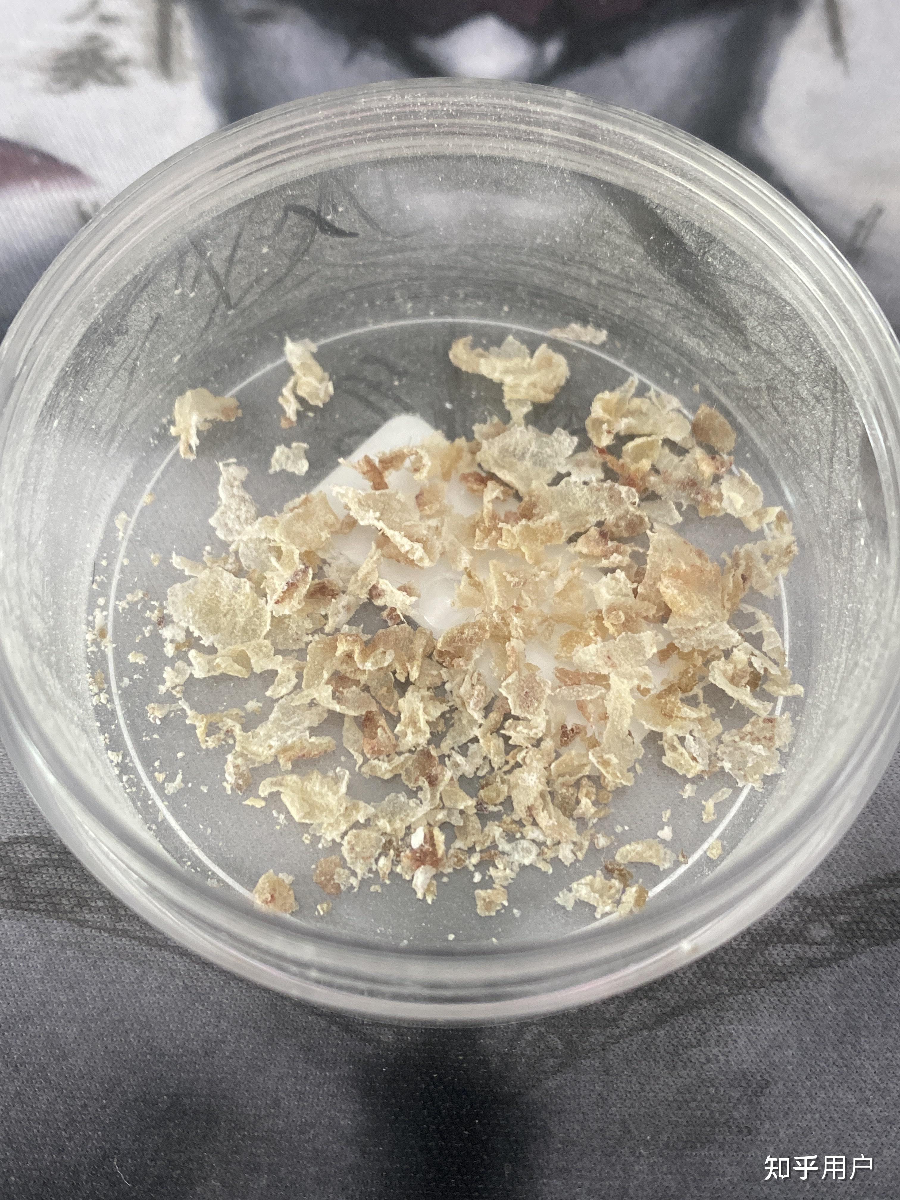 掏出一块超大耳屎,是种什么体验?