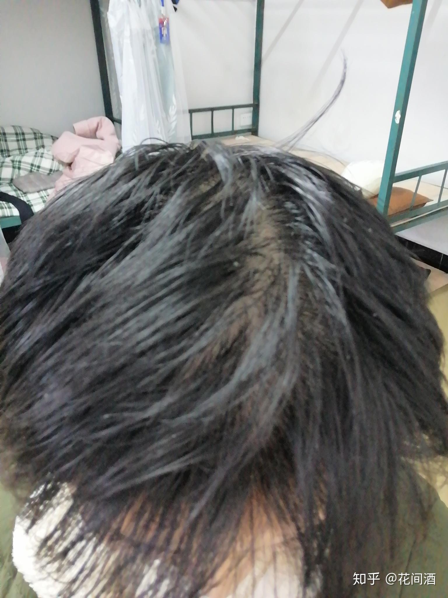 女生头旋这样是不是要秃