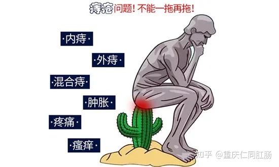 重庆治疗肛门医院?外痔疮出血怎么治疗好呢? - 知乎