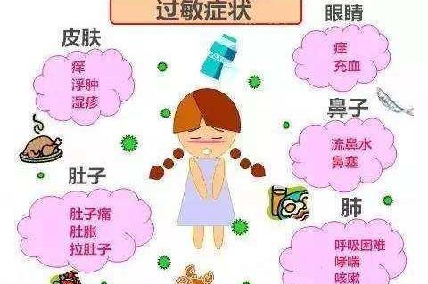 过敏疾病与治疗 - 知乎