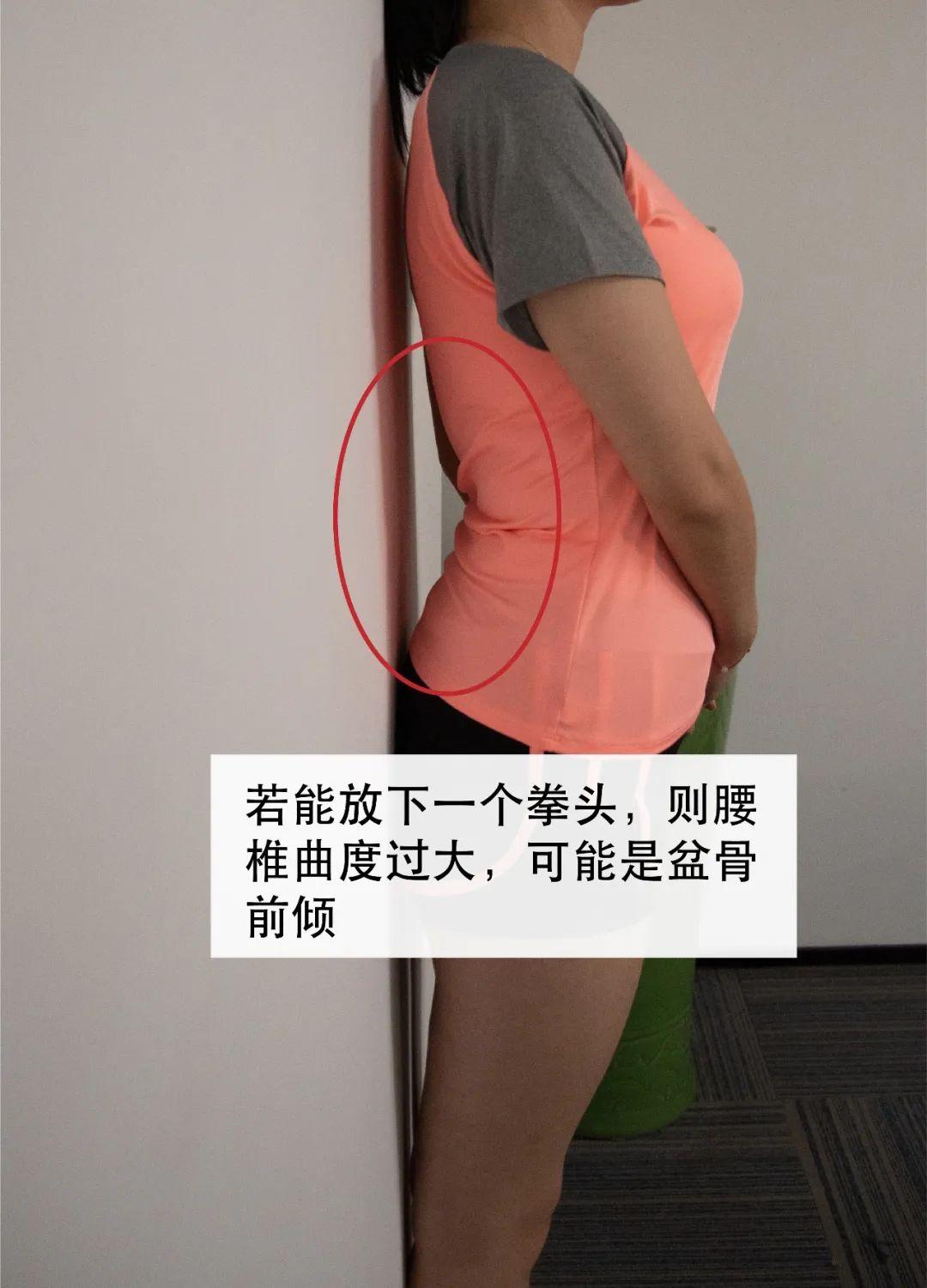 怎么样测试自己是否盆骨前倾