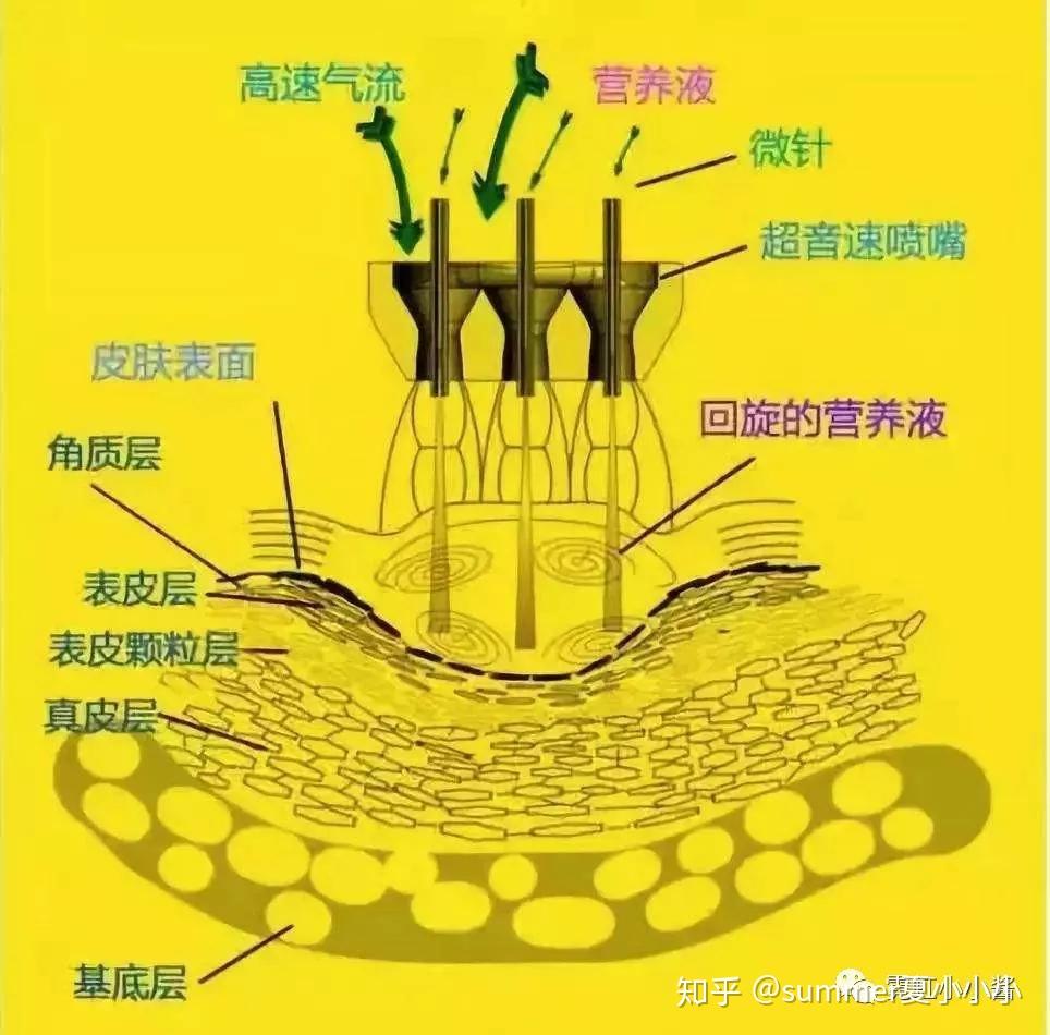 亲身体验打水光针,告诉你们水光针是神助攻还是智商税| 日本医美 亲身体验打水光针,告诉你们水光针是神助攻还是智商税| 日本医美