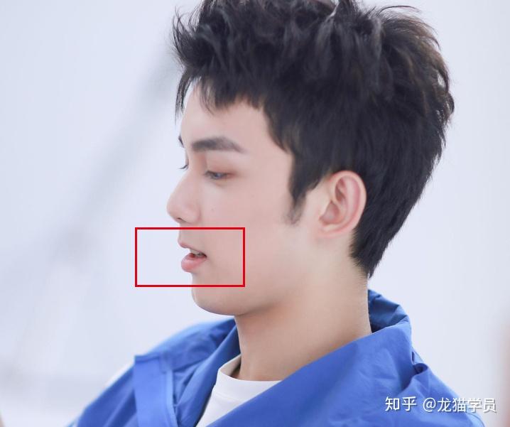 有哪些明星有颌面问题比如地包天