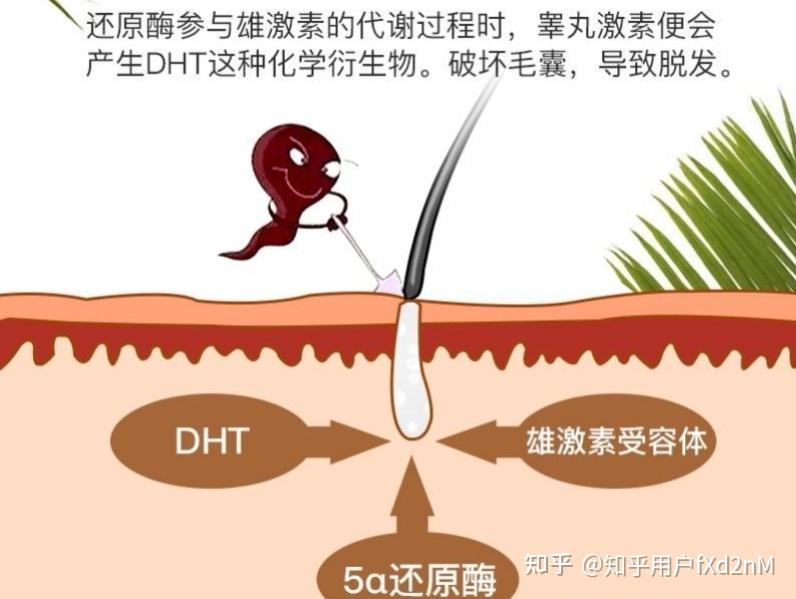 为什么额角更容易脱发? - 知乎