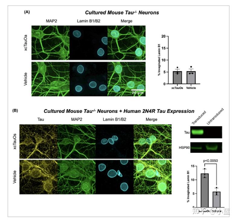Tau441蛋白在阿尔茨海默症（AD）中应用 - 知乎