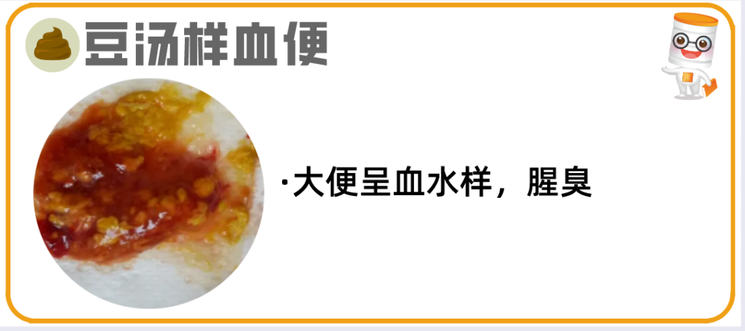 逾20种宝宝大便图片详解！最后10种必须警惕！ - 知乎