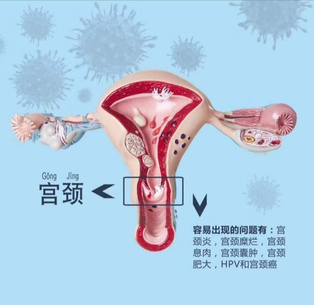 为什么宫颈糜烂一直治不好百科在线