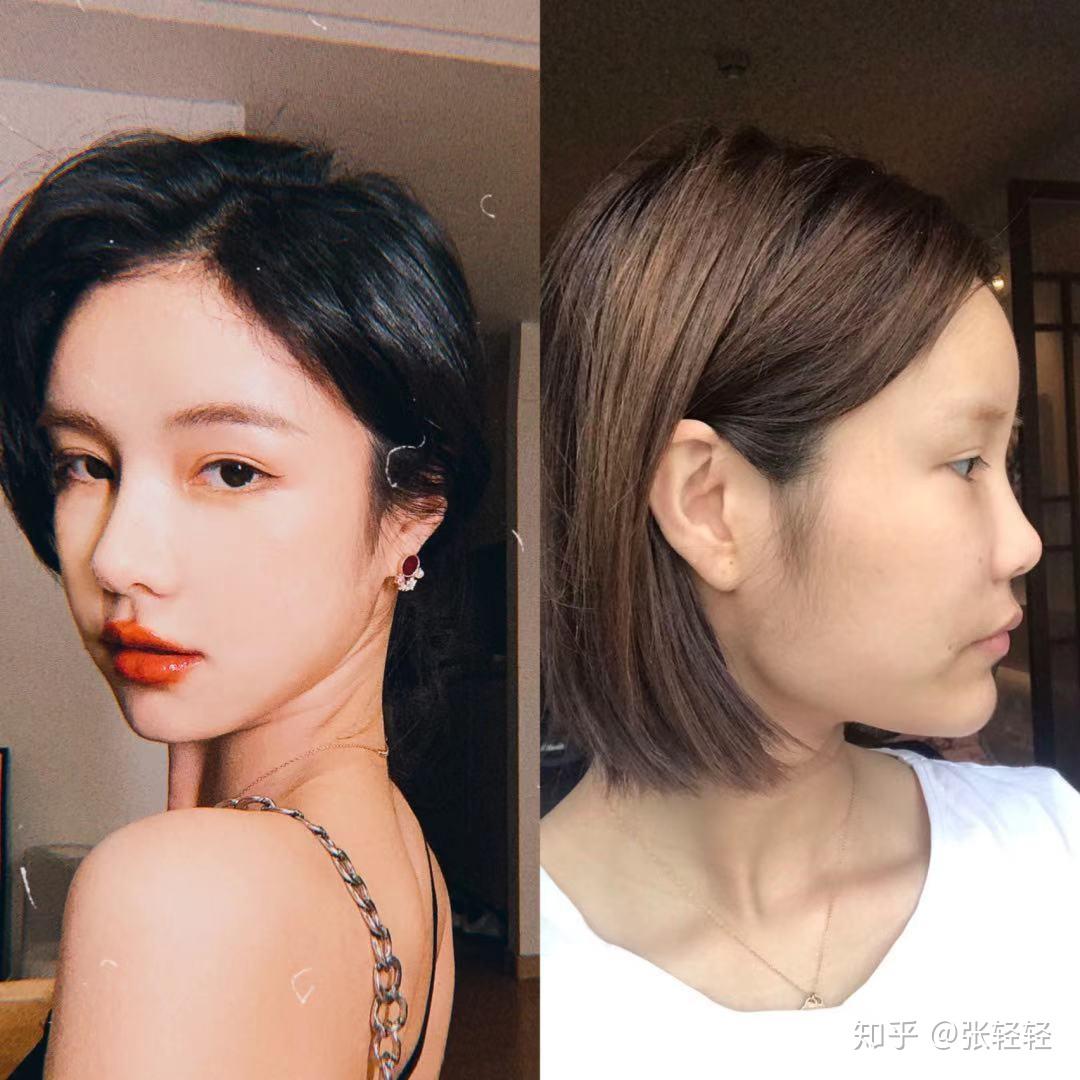 整容成功是什么样的体验? - 知乎