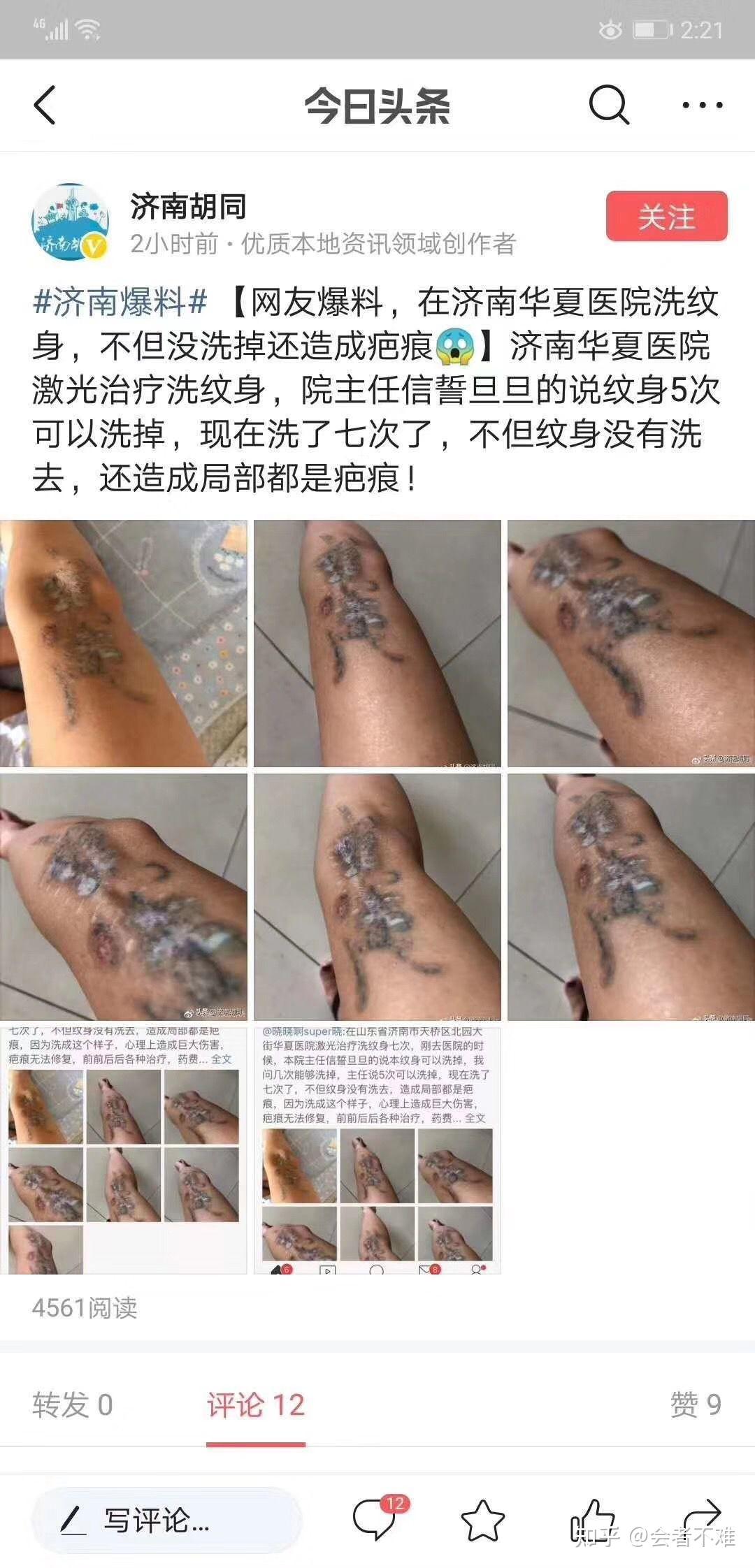 揭阳市有好的洗纹身店吗? 