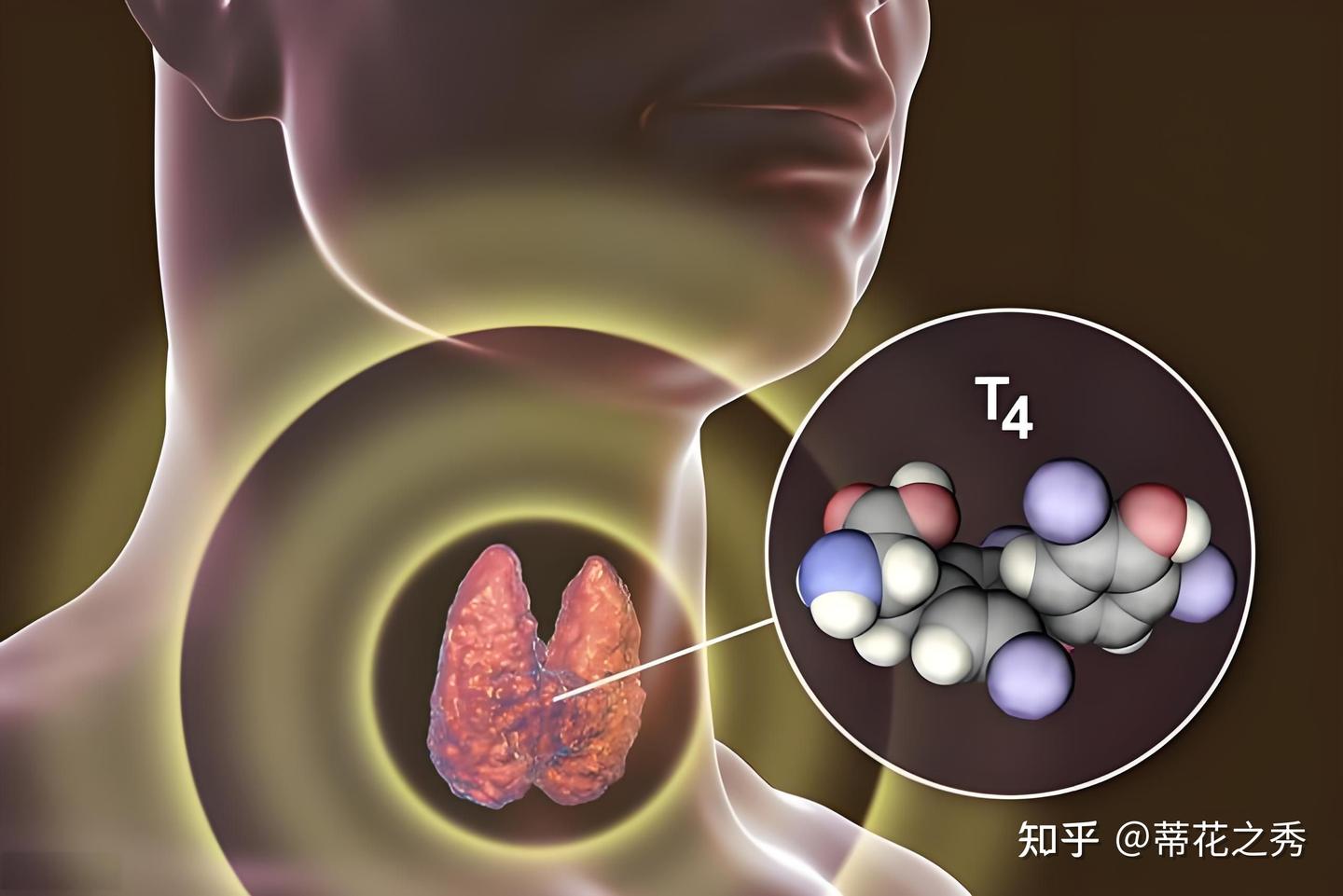 碘-131到底是什么? - 知乎