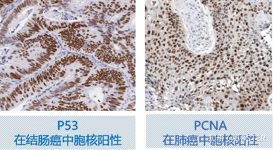 免疫组化(IHC)实验从入门要高阶一篇搞定 - 知乎