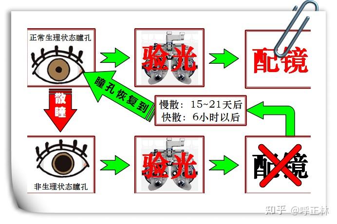为什么散瞳30小时后，瞳孔看起来恢复了，但看进距离看还是模糊？ - 知乎
