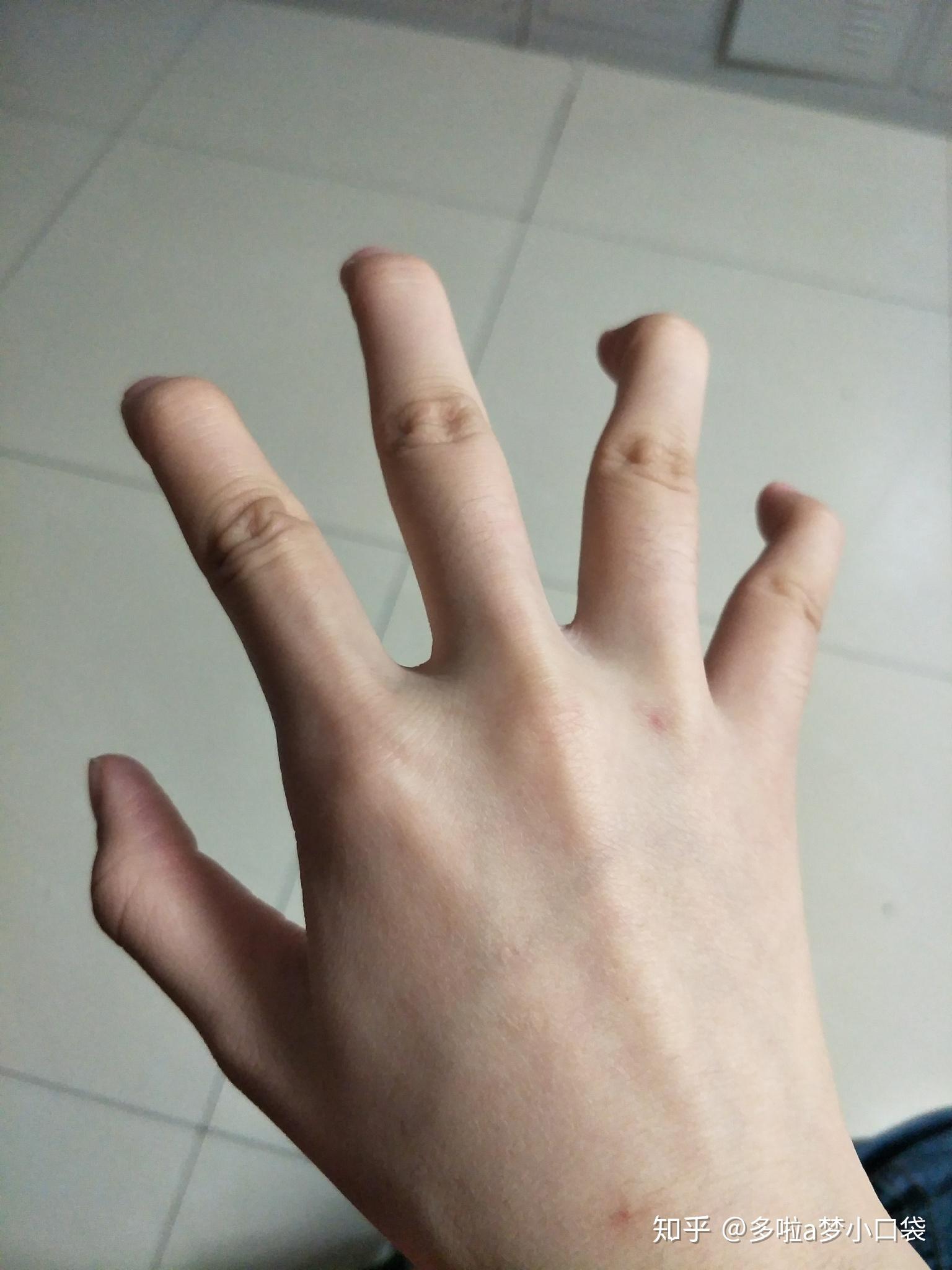 手指第一节可以单独弯曲,为什么?