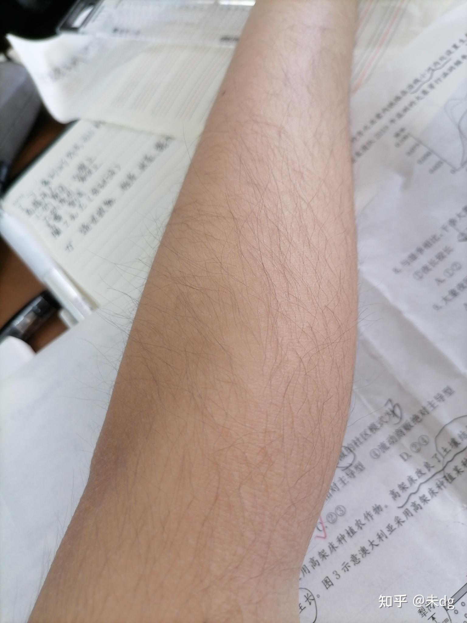 女生长浓密手毛是一种什么样的体验