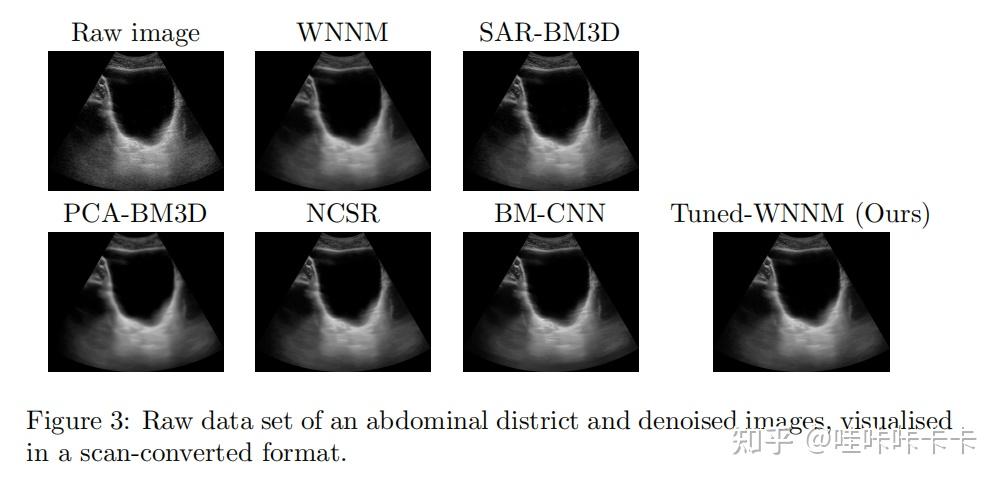 A Universal Deep Learning Framework for Real-Time Denoising of ...