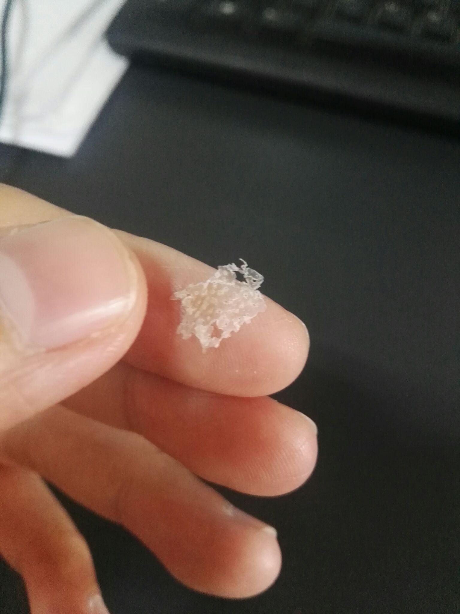 为什么抠下来大块的头皮屑会有瞬间的快感? - 知乎