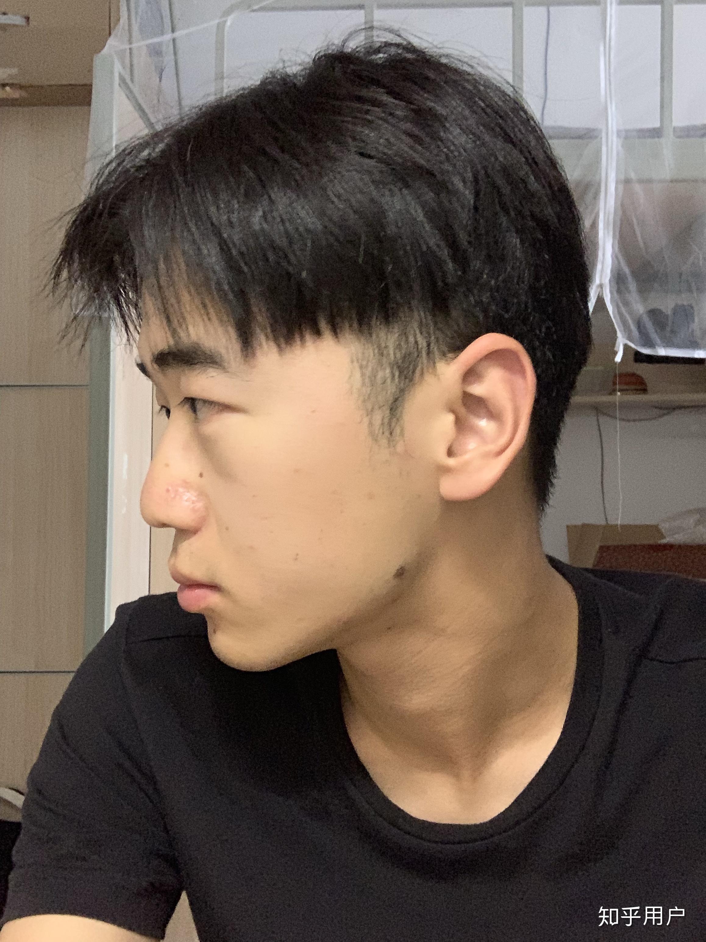 侧脸丑而正脸好看是一种什么体验