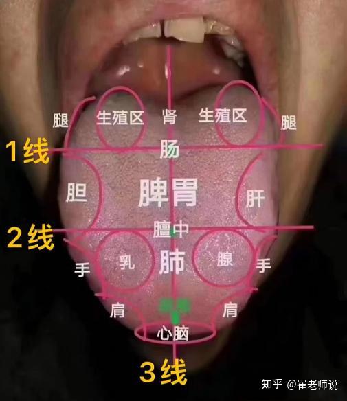 中医舌诊：不同舌象代表什么问题，今天都告诉你！ - 知乎