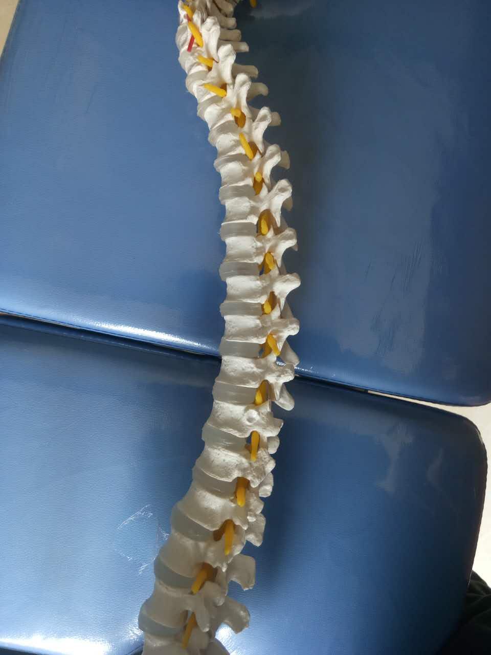 驼背能治好吗小时候习惯性含胸现在颈椎那里的骨头已经有些弯曲19岁还