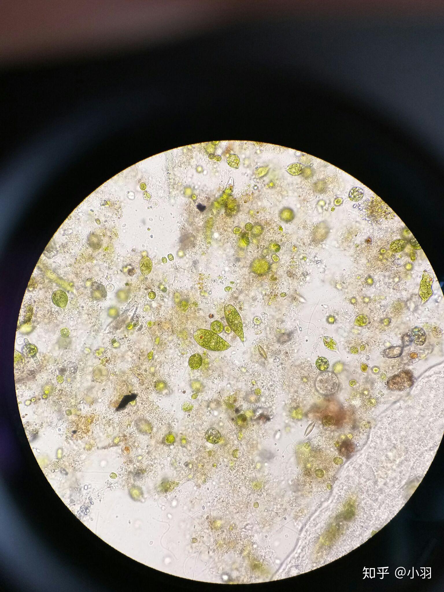 如何在野外找到天蓝喇叭虫(stentor coeruleus)? - 知乎