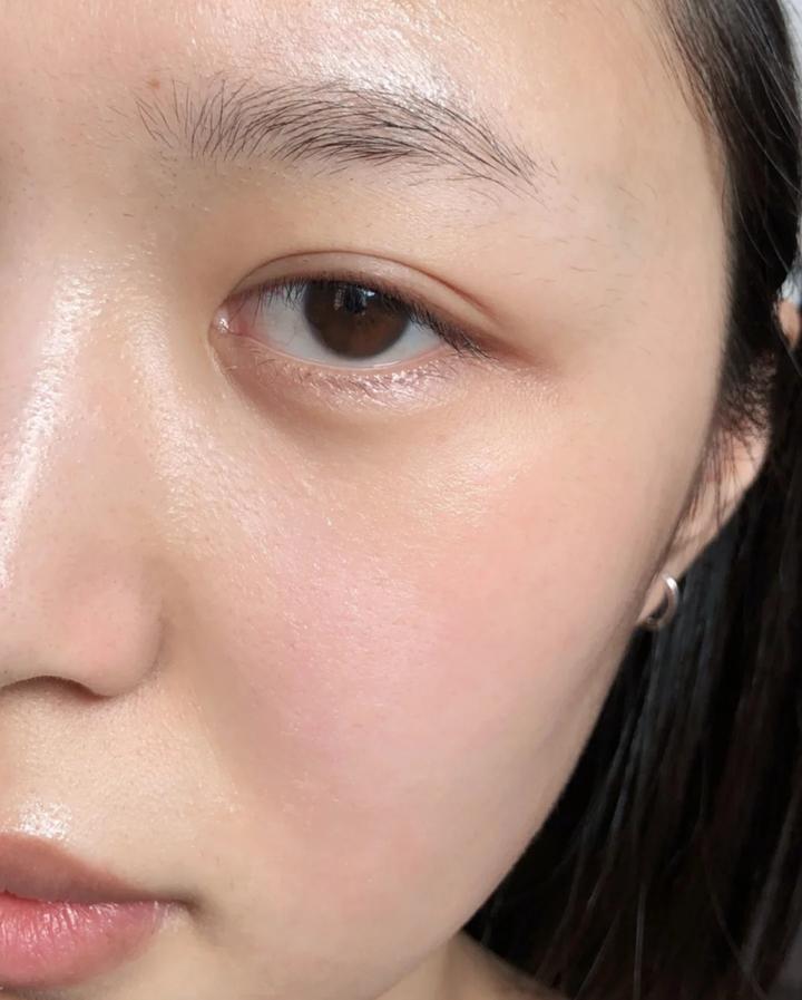 干性敏感肌肤日常该如何护肤?敏感肌怎么修复?