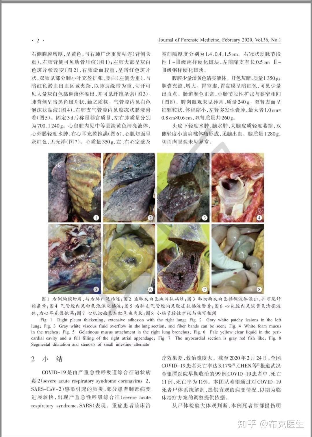 第一例新冠肺炎逝者遗体解剖报告公布有哪些值得关注的信息