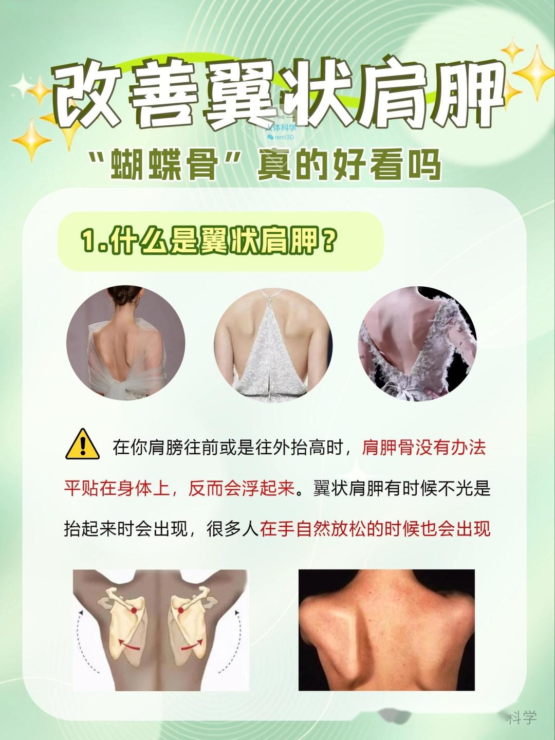翼状肩胛改善蝴蝶背的原理思路和矫正方法