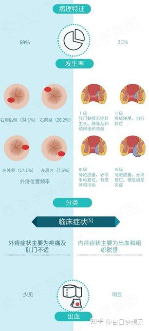 一图了解内痔与外痔 - 知乎