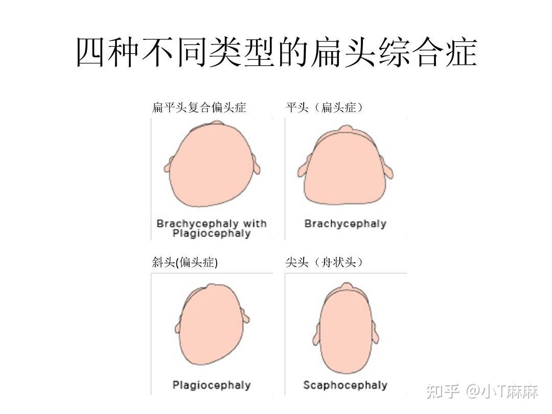 照顾刚出生1-3个月的新生儿宝宝，需要注意哪些方面？ - 知乎