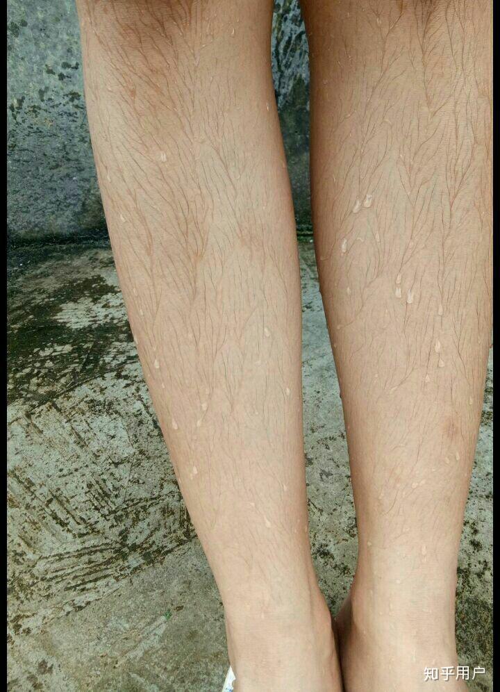 女生腿毛旺盛是怎样的人生体验