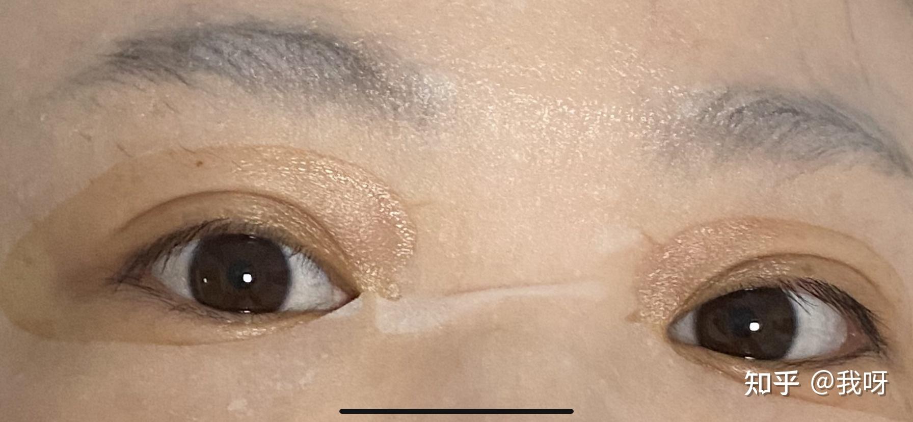 看别人的瞳孔都是褐色茶色觉得好漂亮啊? - 知乎