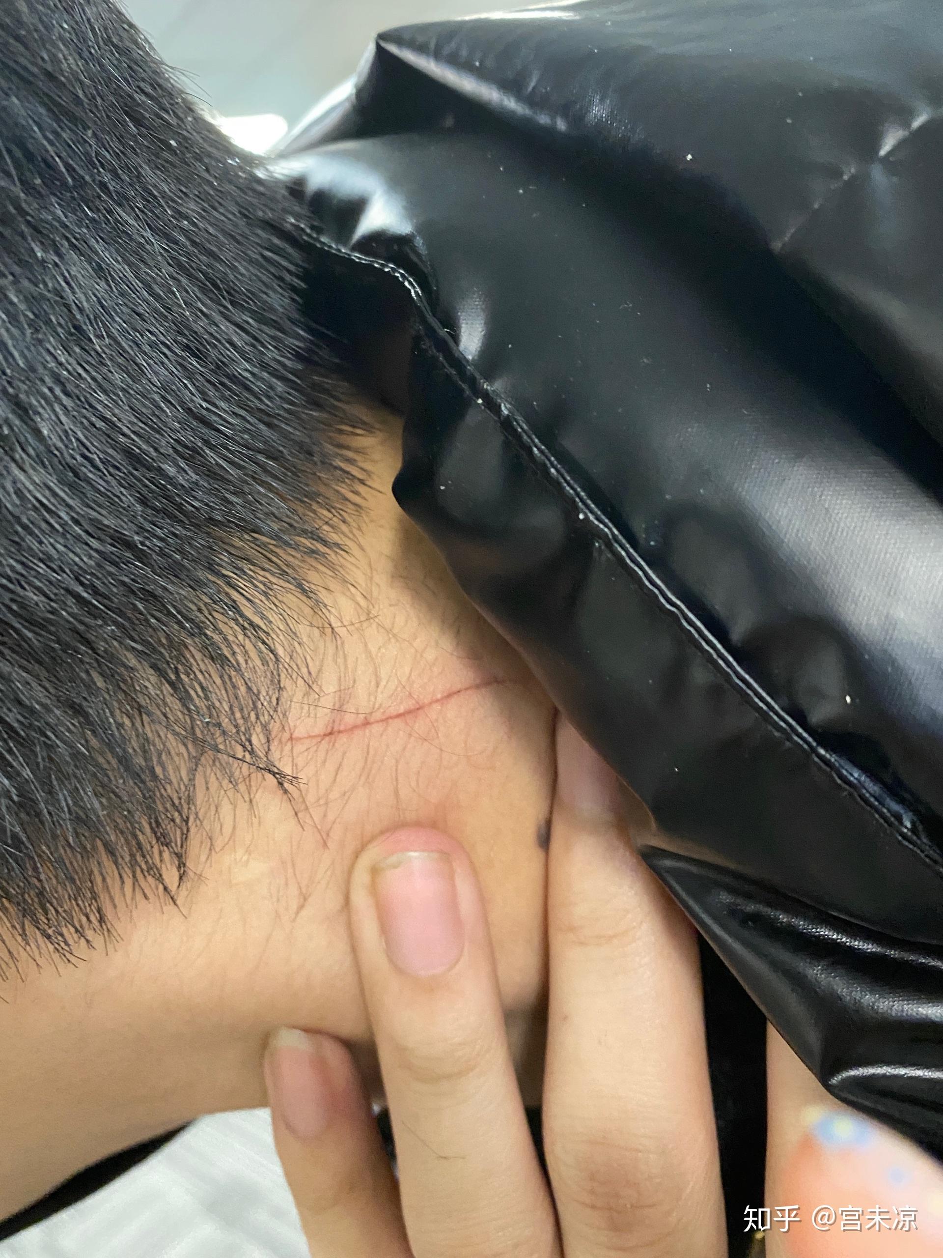 今天身上再次出现莫名划痕求解